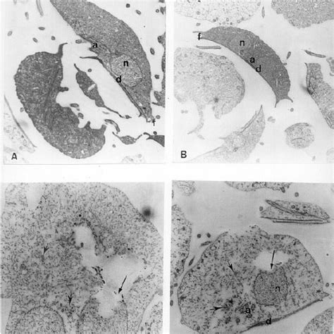 Transmission Electron Micrographs Of G Duodenalis Trophozoites Panel Download Scientific