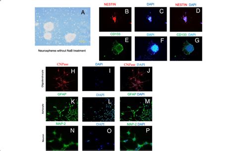 Neural Stem Cell Culture And Characterization A Phase Contrast Image Download Scientific