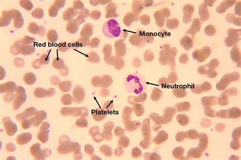 Hematology Society HS Blood Cells In Peripheral Blood Smear 49 OFF