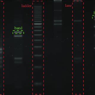 HPV Typing Via PCR RFLP Gel Electrophoresis A The Steps Involved In