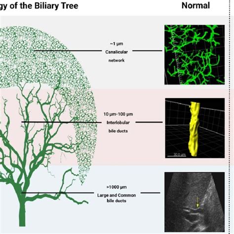 Cholestatic Liver Diseases With Ascending Descending And