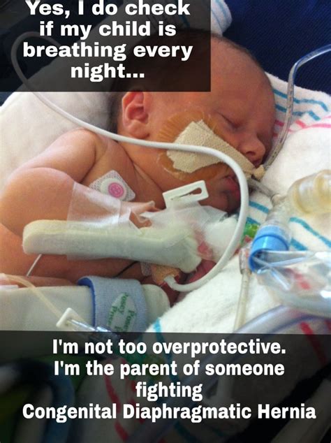 Pin By Cdh Stars Angels On Cdh Awareness Overprotective Parenting