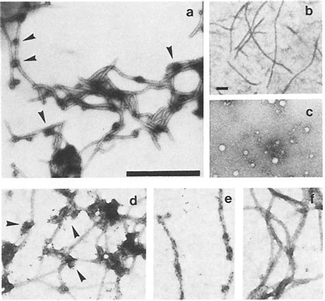 Uranyl acetate staining and immunoelectron microscopy of intermediate ...