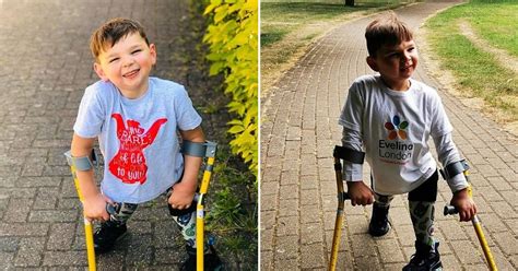 Boy Who Had Both Legs Amputated As A Baby After Parents Mistreated Him