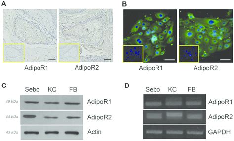 Expression Of Adiponectin Receptors In Human Sebaceous Glands And