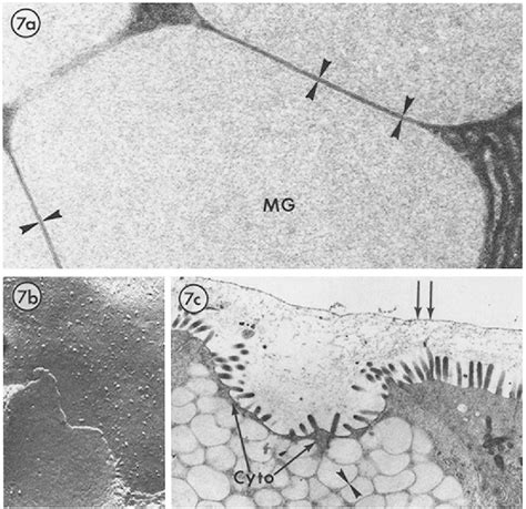 Figure 7 From Mechanism Of Rapid Mucus Secretion In Goblet Cells