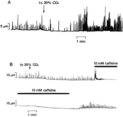 Figure 3 From Acidosis Facilitates Spontaneous Sarcoplasmic Reticulum