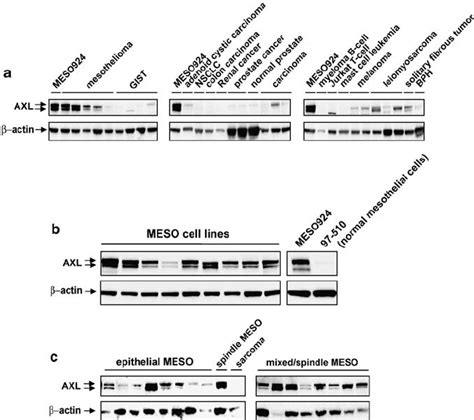 A Immunoblotting Demonstrates Strong Axl Expression In Mesothelioma