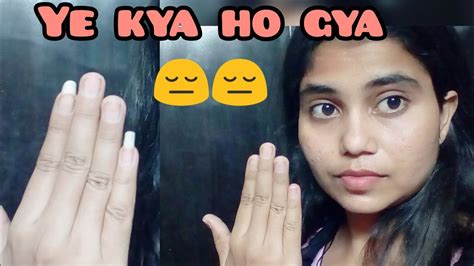 😱 Omg Ye Kya Hua😔😔dailyvlog Youtube