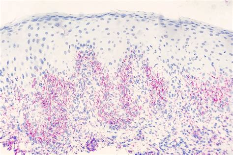 Treponema Pallidum Gram Stain Buying Cheap | gbu-taganskij.ru