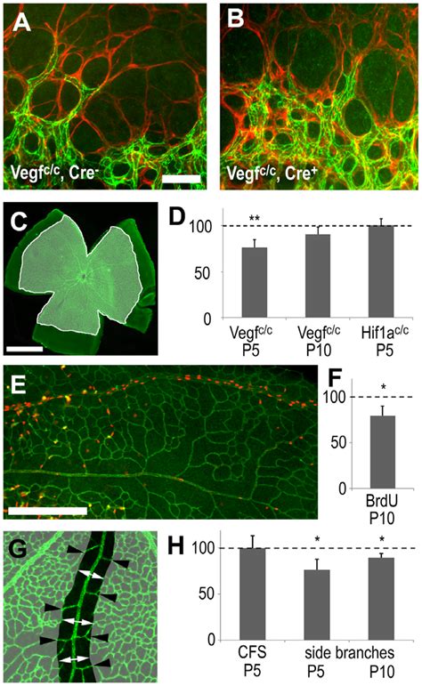 Effects Of Astrocyte Derived Vegf On Retinal Vascular Development