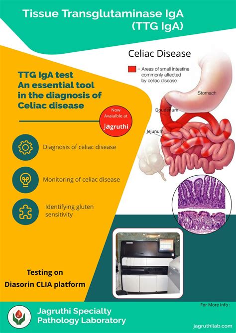 Home Jagruthi Specialty Pathology Laboratory