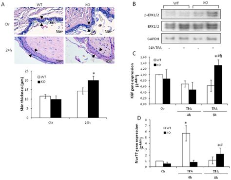 Tm7sf2 Controls TPA Induced Epidermal Hyper Proliferation WT And