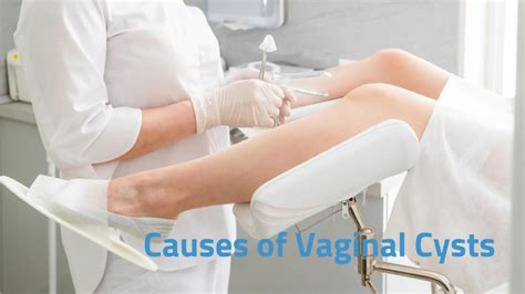 Vaginal Cysts The Best Way To Diagnose And Treat 2024