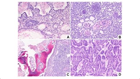 Histological Analysis Of Surgical Specimens By Hematoxylin And Eosin