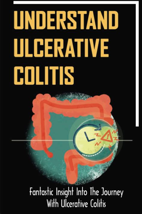 Understand Ulcerative Colitis Fantastic Insight Into The Journey With Ulcerative Colitis Suazo