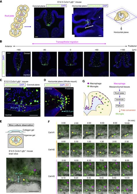 Cd Macrophages Transventricularly Infiltrate The Early Embryonic