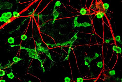 Map of microglia in mouse brain may reveal role in autism | Spectrum ...