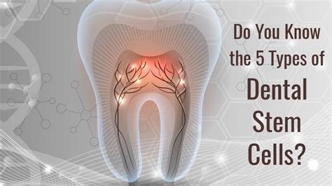 Do You Know The 5 Types Of Dental Stem Cells Bioinformant