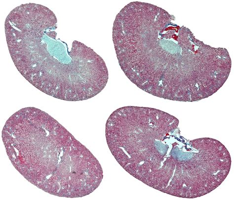 Thank you for your help! A few members offered great advice in response