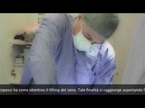 DR MASSIMO RE LIFTING DEL SENO YouTube