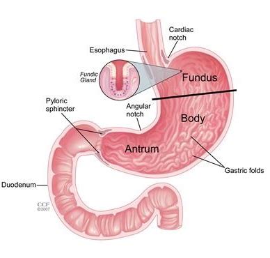 Gastroparesis Gejala Penyebab Dan Cara Pengobatan Idn Medis