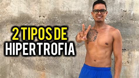 Los Tipos De Hipertrofia Sarcoplasm Tica Y Miofibrilar Vlog