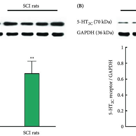 Expression Of 5 Ht 2a Receptors A And 5 Ht 2c Receptors B In