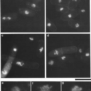 Dapi Stained Fluorescence Micrographs Of The S Pombe Wild Type A And