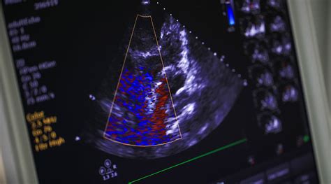 Echocardiogram – Vivekanand Arogya Kendra