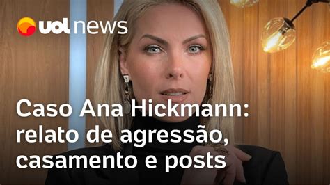 Ana Hickmann Se Casou Alexandre Correa Aos Anos Veja Relato De