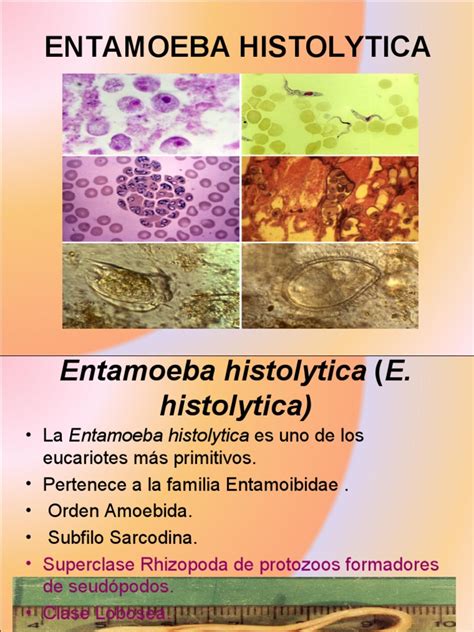 Entamoeba Histolytica Pdf Microbiología Enfermedades Y Trastornos