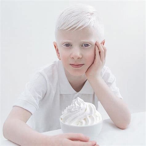 20 Stunning Portraits Showing Albinisms Beauty