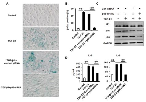 TGF β and NF κB signaling pathway crosstalk potentiates corneal