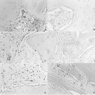 Osteoblast Cells In An Area Of New Bone Formation Showing A Strong