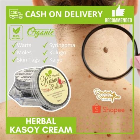 PCS Herbal Kasoy Cream Effective For Warts And Mole Remover 5g By