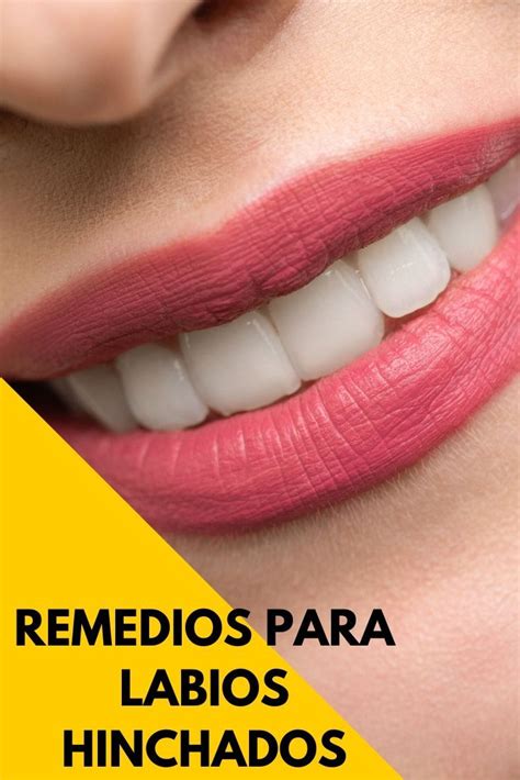 Pin En Labios Remedios Caseros