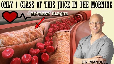 Only A Glass Of This Juice Will Help You Unclog Arteries Info You