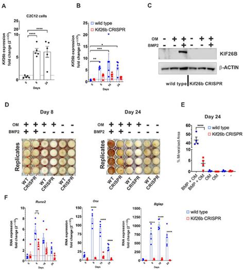 IJMS Free Full Text The Kinesin Gene KIF26B Modulates The Severity