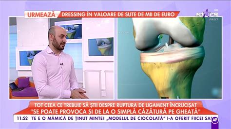 Tot ceea ce trebuie să știi despre ruptura de ligament încrucișat YouTube