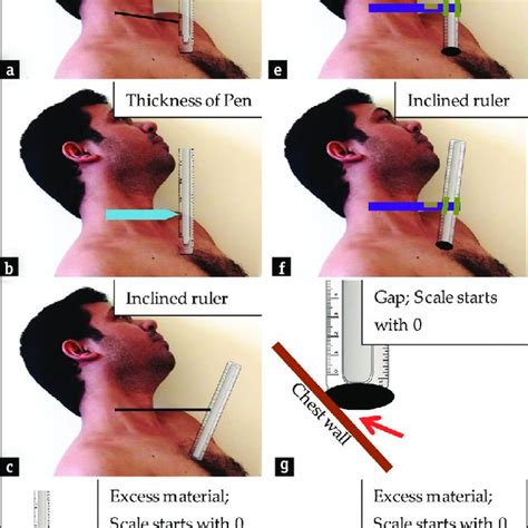 Common problem of available devices used for bedside jugular venous... | Download Scientific Diagram