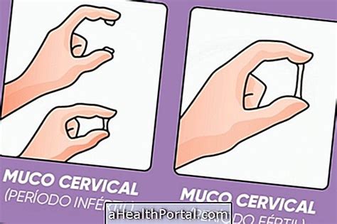 Que Peut Dire La Glaire Cervicale Sur La P Riode Fertile Fertilit