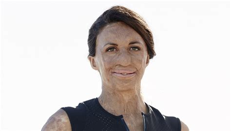 Turia Pitt When You Have The Right Mindset Anything Is Possible