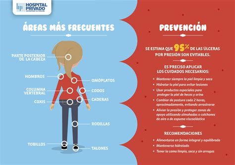 Úlceras por presión la Importancia de la prevención