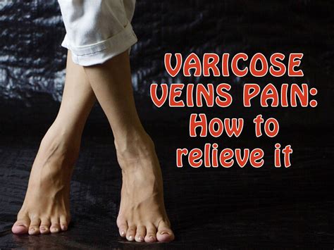 How To Prevent Varicose Vein Pain Archives Denver Vein Center