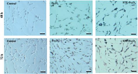 Prussian Blue Staining Of C Glioma Cells Indicating Cellular