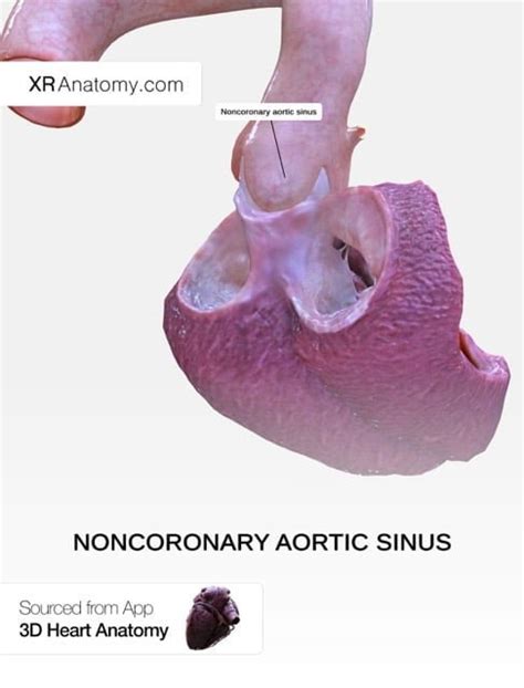 Aortic Valve - XR Anatomy