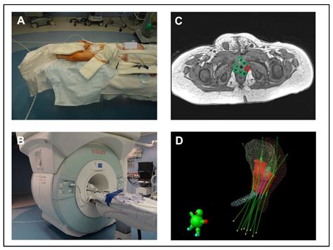 Cancers Free Full Text Increasing Patient Safety And Treatment