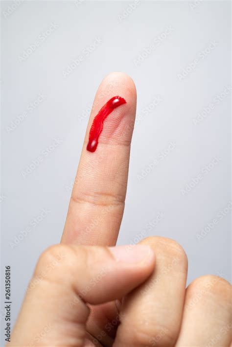 Bleeding Blood From The Cut Finger Wound Injured Finger With Bleeding