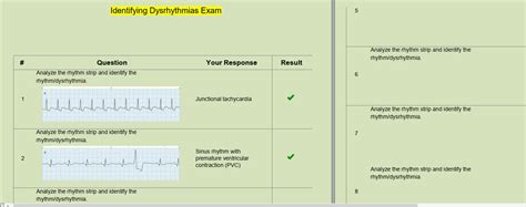 Relias Dysrhythmia Basic Test 2023 Questions And Answers Verified Answers Etsy